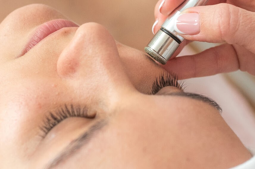 Gyémántfejes mikrodermabrázió